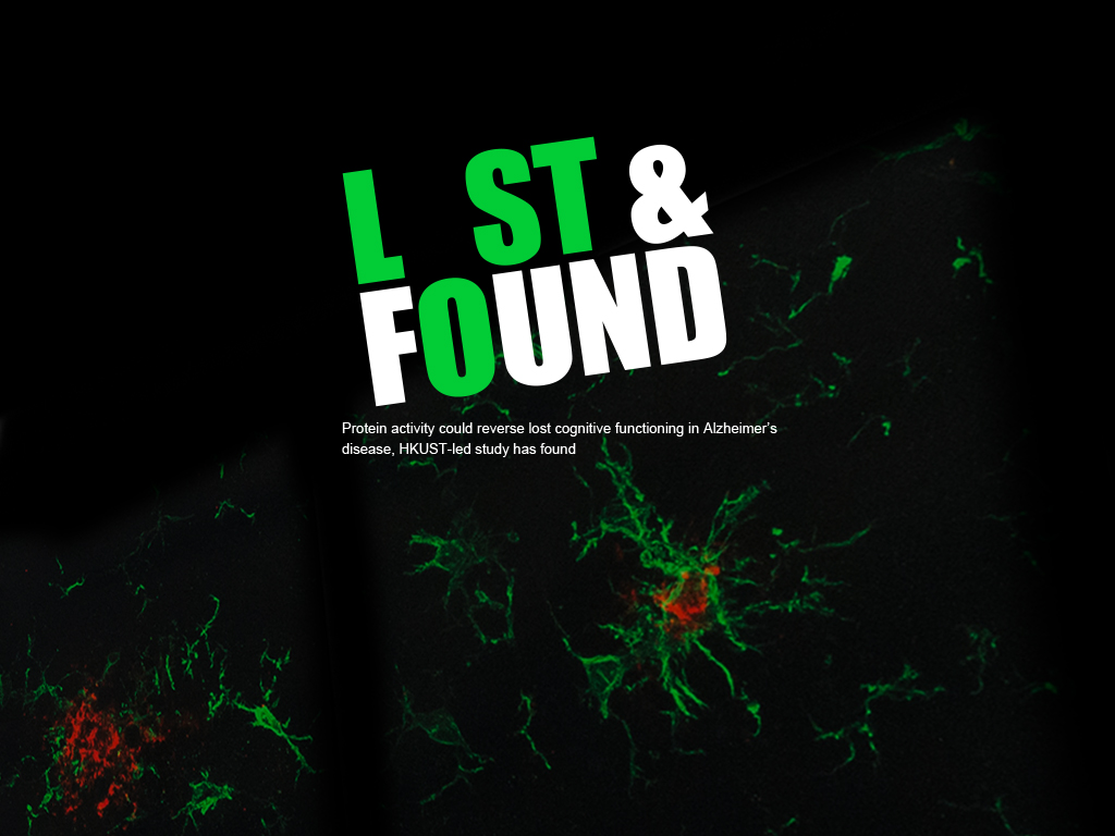 Protein activity could reverse lost cognitive functioning in Alzheimer’s disease, HKUST-led study has found