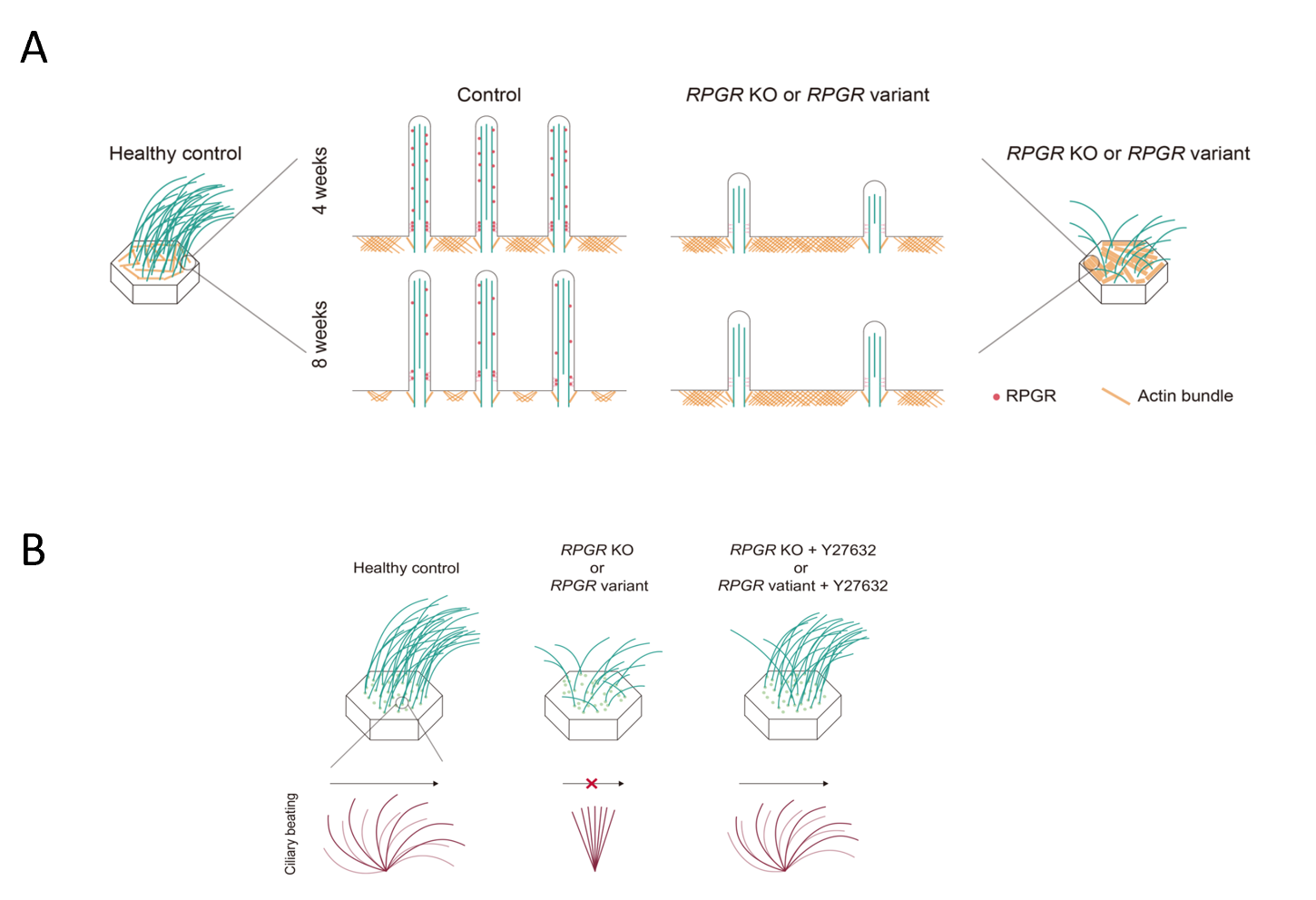The multiciliated cells from patients with RPGR variants have sparse, short, and mostly static cilia. These defects can be ameliorated by treatments that disrupt F-actin accumulation.  